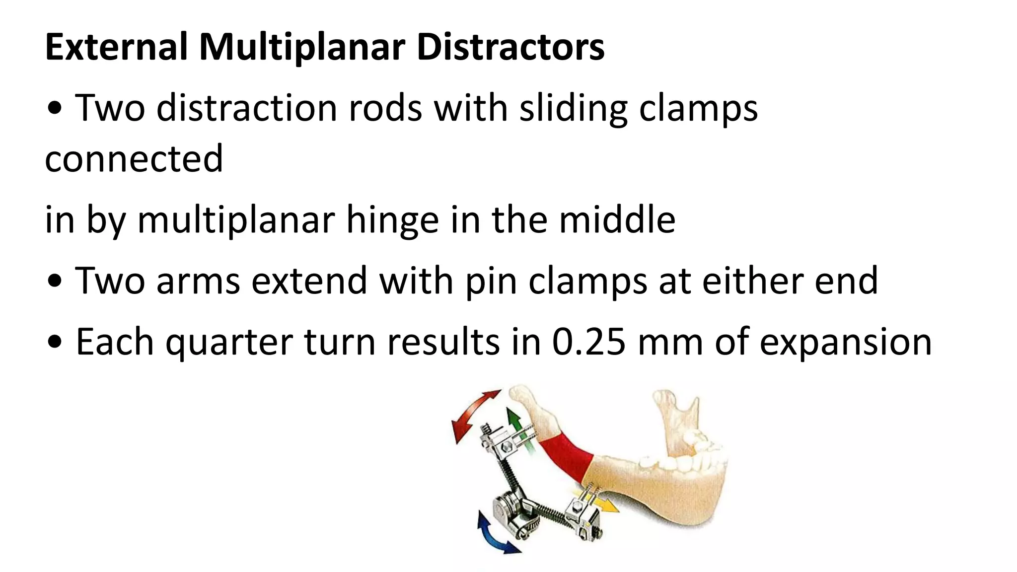 Distraction osteogenesis in orthodontics -Dr.G V SHETTY | PPTX
