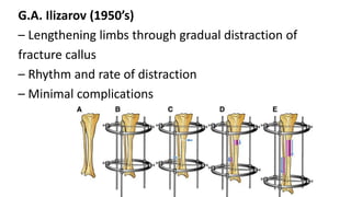 Distraction osteogenesis in orthodontics -Dr.G V SHETTY | PPTX