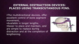 Distraction osteogenesis in maxillofacial surgery | PPTX