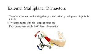Distraction Osteogenesis new orthodontics.pptx