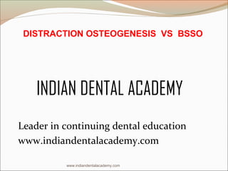 DISTRACTION OSTEOGENESIS VS BSSO

INDIAN DENTAL ACADEMY
Leader in continuing dental education
www.indiandentalacademy.com
www.indiandentalacademy.com

 