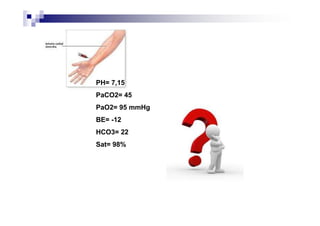 PH= 7,15
PaCO2= 45
PaO2= 95 mmHg
BE= -12
HCO3= 22
Sat= 98%
 