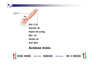 PH= 7,15
      PaCO2= 45
      PaO2= 95 mmHg
      BE= -12
      HCO3= 22
      Sat= 98%

      Acidose mista

CO2 +H2O          H2CO3   H+ + HCO3
 