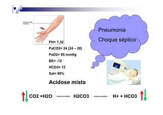 Pneumonia

      PH= 7,32
                            Choque séptico
      PaCO2= 24 (24 – 28)
      PaO2= 95 mmHg
      BE= -12
      HCO3= 12
      Sat= 98%

      Acidose mista

CO2 +H2O            H2CO3        H+ + HCO3
 