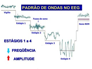 PADRÃO DE ONDAS NO EEG FREQÜÊNCIA   AMPLITUDE   ESTÁGIOS 1 a 4   Estágio 3 Estágio 2 Estágio 1 Fusos de sono    Vigília Sono REM Estágio 4 