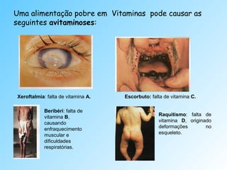 Uma alimentação pobre em Vitaminas pode causar as
seguintes avitaminoses:




Xeroftalmia: falta de vitamina A.   Escorbuto: falta de vitamina C.

            Beribéri: falta de
            vitamina B,                           Raquitismo: falta de
            causando                              vitamina D, originado
            enfraquecimento                       deformações        no
            muscular e                            esqueleto.
            dificuldades
            respiratórias.
 