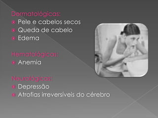 Distúrbios Alimentares