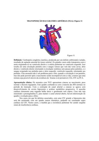 TRANSPOSIÇÃO DAS GRANDES ARTÉRIAS (TGA): Figura 11




                                                                    Figura 11

Definição: Cardiopatia congênita cianótica, produzida por um defeito embrionário isolado,
resultado da septação anormal do tronco arterial. Os grandes vasos estão transpostos com a
aorta originando-se no ventrículo direito e a artéria pulmonar no ventrículo esquerdo. Isso
resulta em uma circulação paralela com o sangue venoso que vem das veias cavas, átrio
direito e ventrículo direito retornando à circulação sistêmica sem passar pelos pulmões, e o
sangue oxigenado nos pulmões para o átrio esquerdo, ventrículo esquerdo, retornando aos
pulmões. Esta anomalia não é um problema para o feto, quando a circulação é em paralelo,
mas não pode persistir após o nascimento sendo incompatível com a vida, a menos que uma
mistura seja possível através da existência de forame oval permeável, CIA, CIV ou PCA.

Apresentação clínica: Os neonatos com TGV apresentam cianose ao nascimento, peso
normal e discreta taquipnéia. Este quadro confunde-se com a maioria dos RN normais no
período de transição. Com a contração do canal arterial a cianose se agrava com
desenvolvimento de severa hipoxemia e acidose metabólica progressiva. A ausculta
cardíaca demonstra uma segunda bulha única e geralmente sem sopros. Caso não seja
ministrado a prostaglandina E, para manter o canal arterial aberto, haverá deterioração do
quadro e evolução para o óbito.
        Nos casos em que há defeitos associados, com uma CIV grande a hipoxemia não
será tão acentuada, com um quadro menos dramático, podendo ser constatado sopro
cardíaco da CIV. Nestes casos, a medida que a resistência pulmonar for caindo surgirão
sinais de insuficiência cardíaca.
 