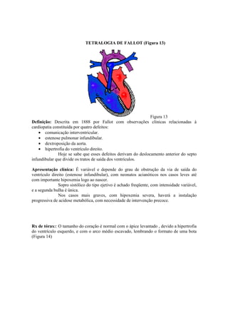 TETRALOGIA DE FALLOT (Figura 13)




                                                                Figura 13
Definição: Descrita em 1888 por Fallot com observações clínicas relacionadas à
cardiopatia constituída por quatro defeitos:
    • comunicação interventricular.
    • estenose pulmonar infundibular.
    • dextroposição da aorta.
    • hipertrofia do ventrículo direito.
               Hoje se sabe que esses defeitos derivam do deslocamento anterior do septo
infundibular que divide os tratos de saída dos ventrículos.

Apresentação clínica: É variável e depende do grau de obstrução da via de saída do
ventrículo direito (estenose infundibular), com neonatos acianóticos nos casos leves até
com importante hipoxemia logo ao nascer.
               Sopro sistólico do tipo ejetivo é achado freqüente, com intensidade variável,
e a segunda bulha é única.
               Nos casos mais graves, com hipoxemia severa, haverá a instalação
progressiva de acidose metabólica, com necessidade de intervenção precoce.




Rx de tórax:: O tamanho do coração é normal com o ápice levantado , devido a hipertrofia
do ventrículo esquerdo, e com o arco médio escavado, lembrando o formato de uma bota
(Figura 14)
 