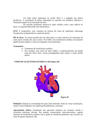 Um dado muito importante no exame físico é a palpação dos pulsos
periféricos. A constatação de pulsos diminuídos ou ausentes nos membros inferiores é
fortemente sugestiva de coarctação da aorta.
             Na ausculta geralmente observa-se sopro sistólico suave, mais audível no
dorso. A segunda bulha pode estar hipofonética.

ECG: É inespecífico, com variações do normal até sinais de importante sobrecarga
biventricular ou hipertrofia do ventrículo direito.

RX de tórax: No recém-nascido não são observados os sinais clássicos de coarctação da
aorta como corrosão dos arcos costais. Nos bebês com insuficiência cardíaca, há aumento
global da área cardíaca e sinais de congestão venosa pulmonar.

Tratamento:
         • Tratamento da insuficiência cardíaca.
         • Nos neonatos com sinais de baixo débito e comprometimento da função
            renal por baixo fluxo, iniciar prostaglandina para manter o canal arterial
            aberto.


 COMUNICAÇÃO INTRAVENTRICULAR (Figura 20)




                                                              Figura 20


Definição: Solução de continuidade do septo interventricular. Pode ter várias localizações,
sendo as mais freqüentes nas regiões perimembranosa e muscular.

Apresentação clínica: Geralmente não apresenta sintomas nos neonatos devido à
resistência pulmonar elevada. Nas grandes comunicações interventriculares, sugirão
sintomas de insuficiência cardíaca com a queda de resistência pulmonar, que ocorrerá em
torno da quarta semana de vida.
 