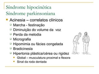 Síndrome hipocinética 
Síndrome parkinsoniana 
 Acinesia – correlatos clínicos 
 Marcha - festinação 
 Diminuição do volume da voz 
 Perda da melodia 
 Micrografia 
 Hipomimia ou fácies congelada 
 Bradicinesia 
 Hipertonia plástica/cérea ou rigidez 
 Global – musculatura proximal e flexora 
 Sinal da roda dentada 
 