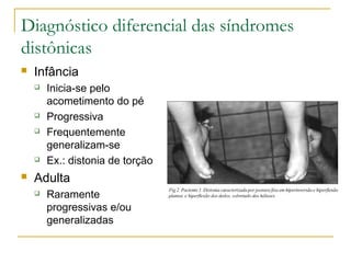 Diagnóstico diferencial das síndromes 
distônicas 
 Infância 
 Inicia-se pelo 
acometimento do pé 
 Progressiva 
 Frequentemente 
generalizam-se 
 Ex.: distonia de torção 
 Adulta 
 Raramente 
progressivas e/ou 
generalizadas 
 