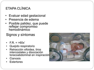 ETAPA CLÍNICA
• Evaluar edad gestacional
• Presencia de edema
• Posible palidez, que puede
reflejar compromiso
hemodinámico
Signos y síntomas
• F.R. = >60x’
• Quejido respiratorio
• Retracción xifoidea, tiros
intercostales y disociación
toracoabdominal en inspiración
• Cianosis
• Estertores
 