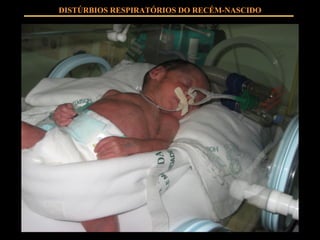 DISTÚRBIOS RESPIRATÓRIOS DO RECÉM-NASCIDO 