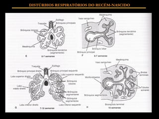 DISTÚRBIOS RESPIRATÓRIOS DO RECÉM-NASCIDO 