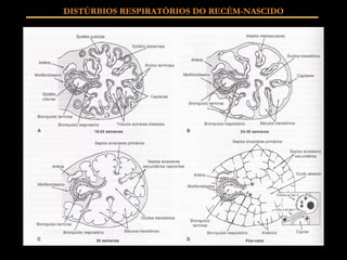 DISTÚRBIOS RESPIRATÓRIOS DO RECÉM-NASCIDO 