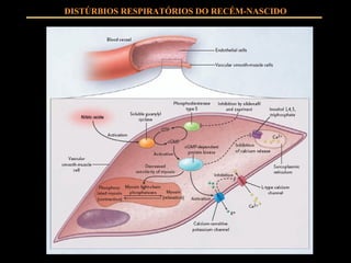 DISTÚRBIOS RESPIRATÓRIOS DO RECÉM-NASCIDO 