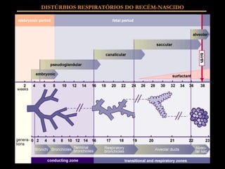 DISTÚRBIOS RESPIRATÓRIOS DO RECÉM-NASCIDO 