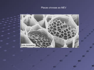 Placas crivosas ao MEV
 