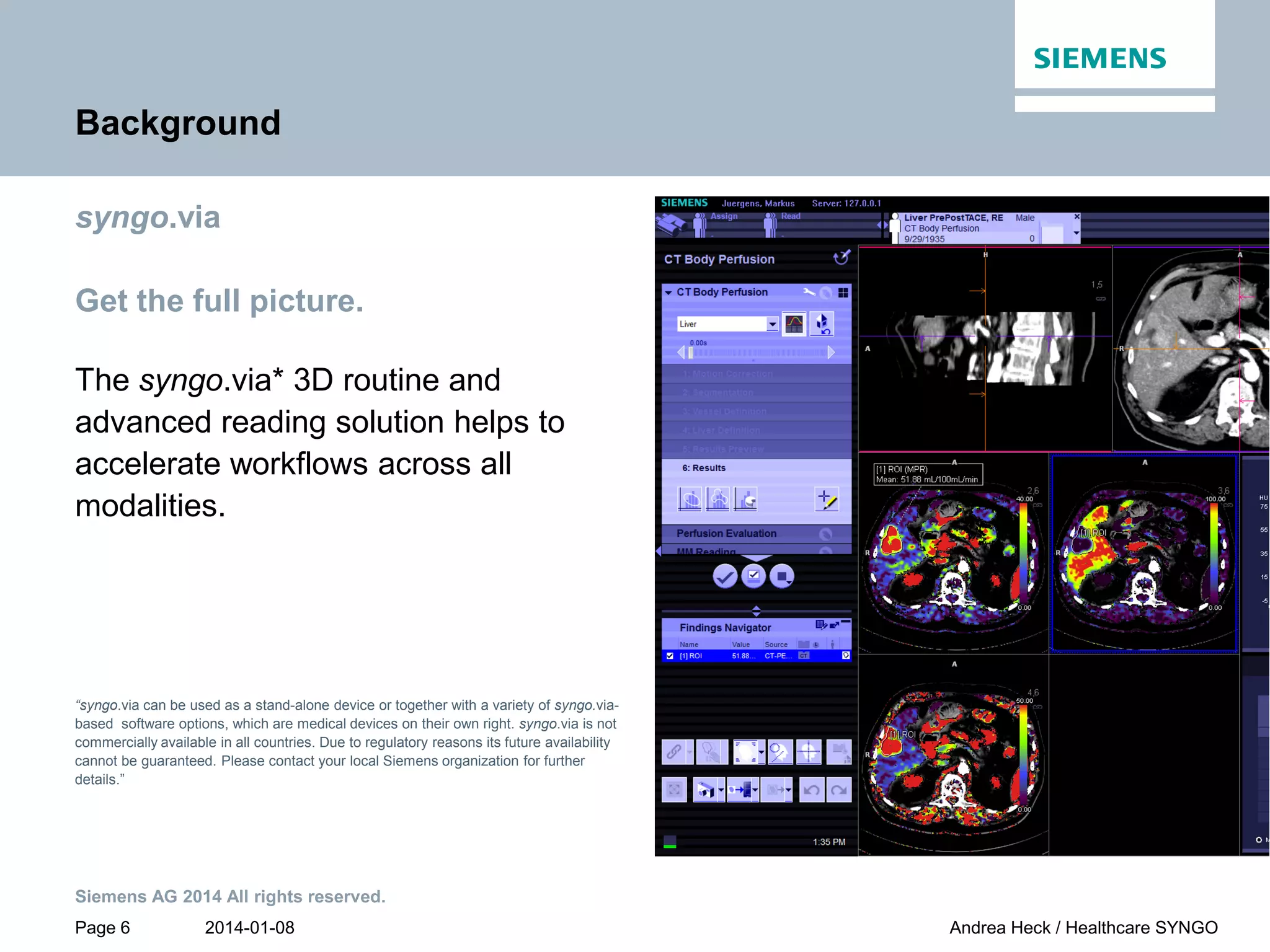 2014-01-08
Siemens AG 2014 All rights reserved.
Page 6 Andrea Heck / Healthcare SYNGO
Background
syngo.via
Get the full picture.
The syngo.via* 3D routine and
advanced reading solution helps to
accelerate workflows across all
modalities.
“syngo.via can be used as a stand-alone device or together with a variety of syngo.via-
based software options, which are medical devices on their own right. syngo.via is not
commercially available in all countries. Due to regulatory reasons its future availability
cannot be guaranteed. Please contact your local Siemens organization for further
details.”
 