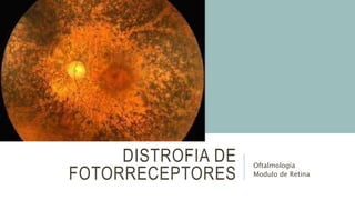 DISTROFIA DE
FOTORRECEPTORES
Oftalmología
Modulo de Retina
 