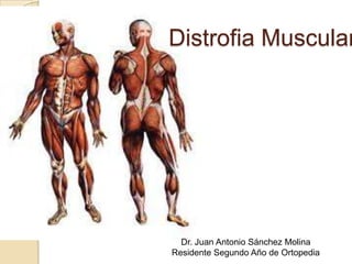 Distrofia Muscular

Dr. Juan Antonio Sánchez Molina
Residente Segundo Año de Ortopedia

 