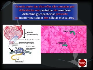 Necrose

Fibrose

 