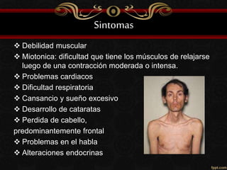 Sintomas
 Debilidad muscular
 Miotonica: dificultad que tiene los músculos de relajarse
luego de una contracción moderada o intensa.
 Problemas cardiacos
 Dificultad respiratoria
 Cansancio y sueño excesivo
 Desarrollo de cataratas
 Perdida de cabello,
predominantemente frontal
 Problemas en el habla
 Alteraciones endocrinas
 