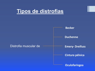 Distrofia muscular | PPTX