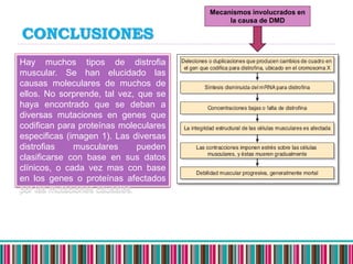 Distrofia muscular de duchenne | PPTX