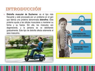 Distrofia muscular de duchenne | PPTX