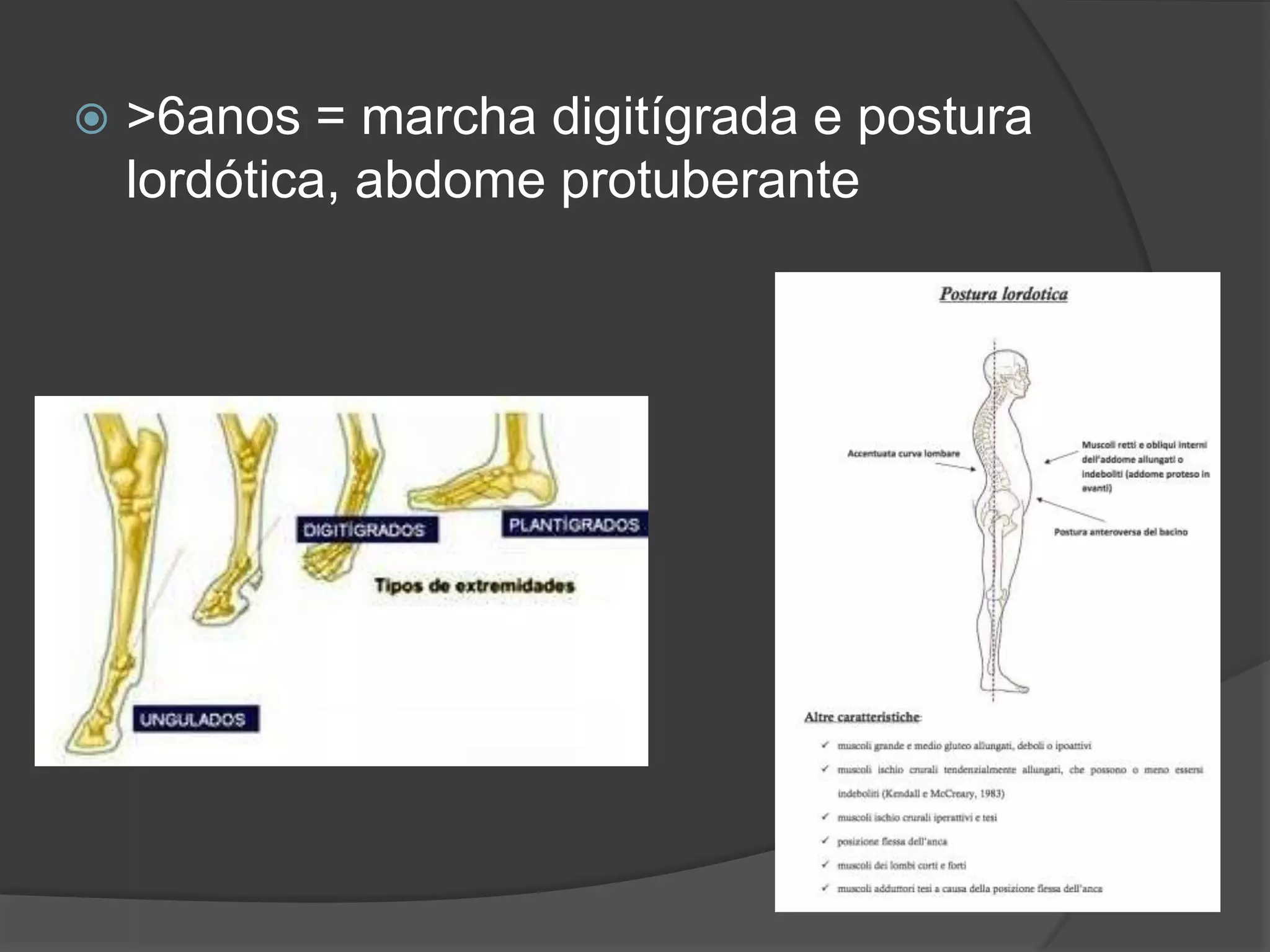 Distrofia muscular de duchenne | PPTX | Medical Health
