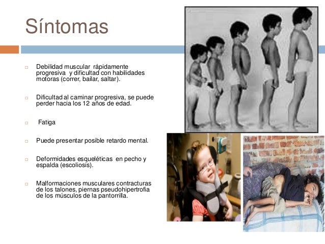 DISTROFIA DEFINICION PDF DOWNLOAD DISTROFIA DEFINICION PDF DOWNLOAD