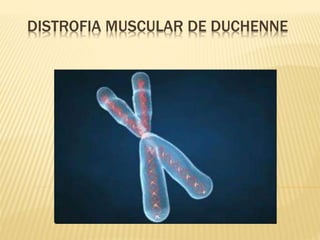 Distrofia muscular de duchenne | PPTX