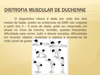 Distrofia muscular de duchenne | PPTX
