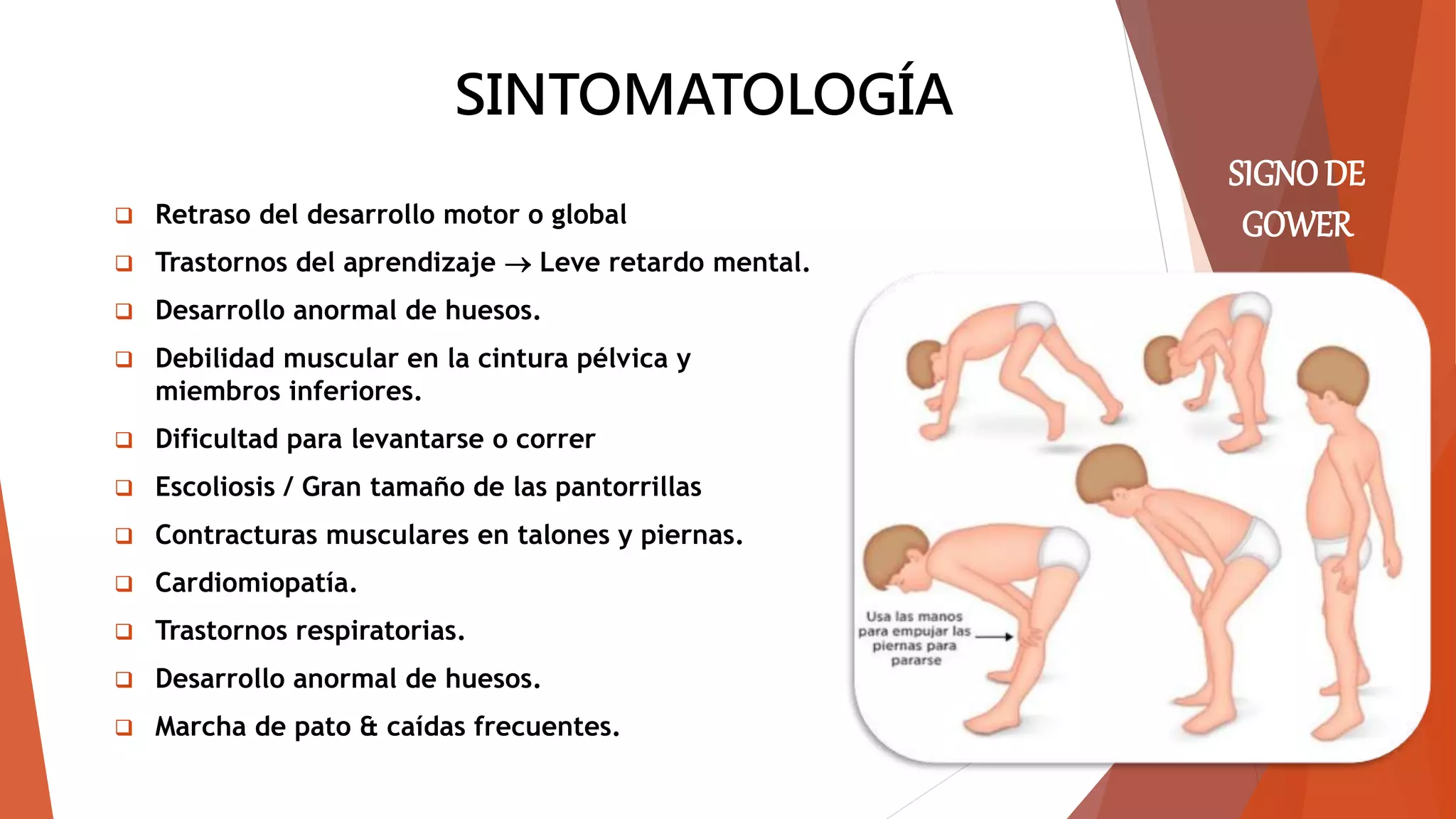 Distrofia muscular de duchenne | PPTX