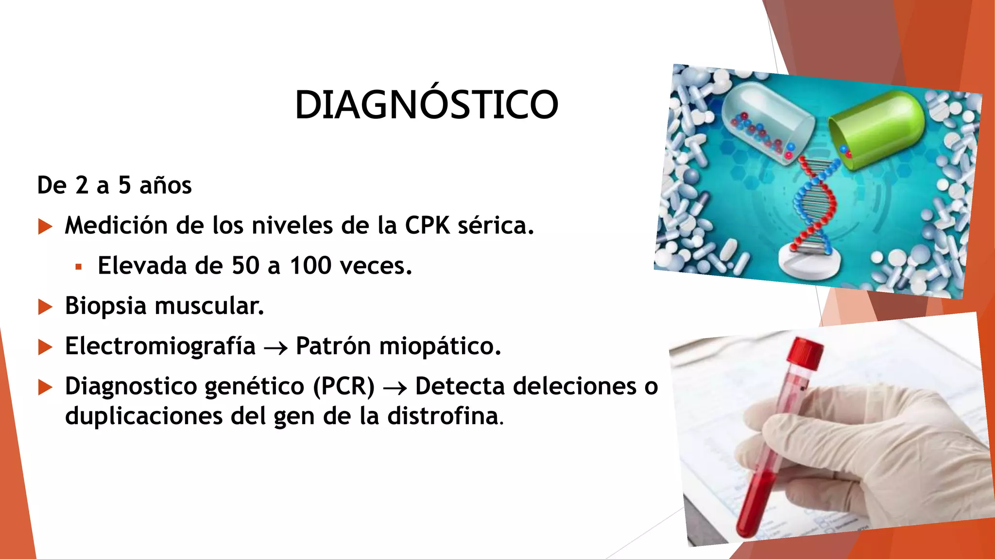 Distrofia muscular de duchenne | PPTX