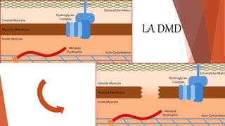 Distrofia muscular de duchenne | PPTX