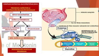 Distrofia muscular de duchenne | PPTX