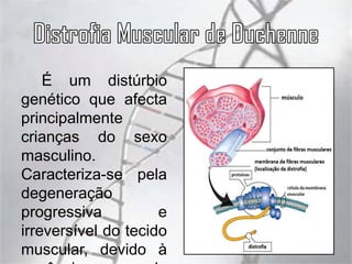 Distrofia Muscular | PPTX