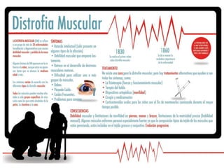 Distrofia Muscular de Duchenne (DMD) | PPTX