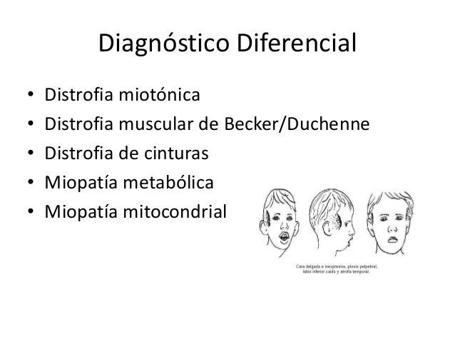 Omim Entry 310200 Muscular Dystrophy Duchenne Type Dmd | omim entry 310200 muscular dystrophy duchenne type dmd Omim Entry 310200 Muscular Dystrophy Duchenne Type Dmd | omim entry 310200 muscular dystrophy duchenne type dmd