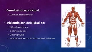 DISTROFIA MUSCULAR DE EMERY - DREIFUSS | PPTX