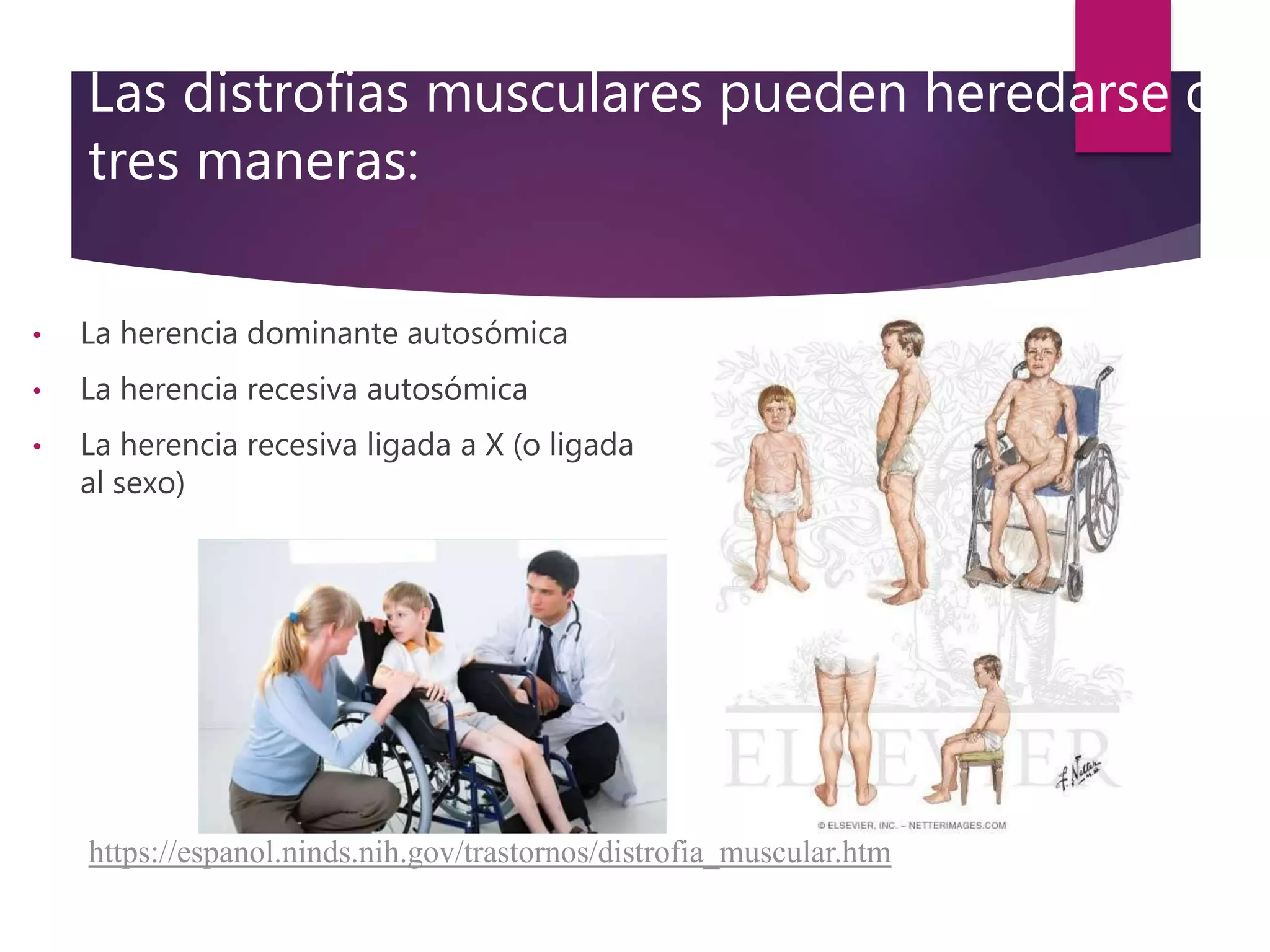 Distrofia muscular diapositivas | PPTX