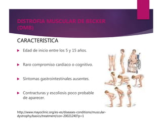 Distrofia muscular diapositivas | PPTX