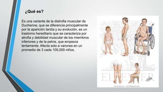 Es una variante de la distrofia muscular de
Duchenne, que se diferencia principalmente
por la aparición tardía y su evolución, es un
trastorno hereditario que se caracteriza por
atrofia y debilidad muscular de los miembros
inferiores y de la pelvis, que empeora
lentamente. Afecta solo a varones en un
promedio de 3 cada 100,000 niños.
¿Qué es?
 