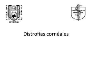 Distrofias cornéales
 