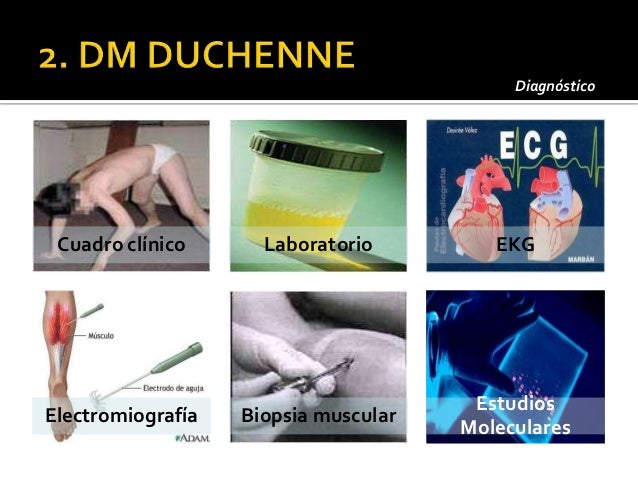 Omim Entry 310200 Muscular Dystrophy Duchenne Type Dmd | omim entry 310200 muscular dystrophy duchenne type dmd Omim Entry 310200 Muscular Dystrophy Duchenne Type Dmd | omim entry 310200 muscular dystrophy duchenne type dmd