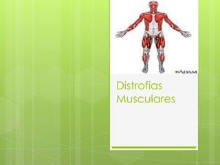 Distrofias
Musculares
 