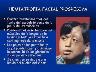 HEMIATROFIA FACIAL PROGRESIVAHEMIATROFIA FACIAL PROGRESIVA
 Existen trastornos troficosExisten trastornos troficos
tanto del esqueleto como de latanto del esqueleto como de la
piel y de los músculospiel y de los músculos
 Pueden atrofiarse también losPueden atrofiarse también los
músculos de la lengua de lamúsculos de la lengua de la
laringe y toda la estructuralaringe y toda la estructura
cartilaginosa de la mismacartilaginosa de la misma
 Los pelos de las pestañas yLos pelos de las pestañas y
cejas pueden caer y disminuyecejas pueden caer y disminuye
la secreción de las glándulasla secreción de las glándulas
sudoríparas y sebáceas.sudoríparas y sebáceas.
 Se cree que se debe a unaSe cree que se debe a una
lesión del núcleo del V par.lesión del núcleo del V par.
 